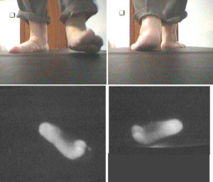 Peu pla tractament a NOU DMP