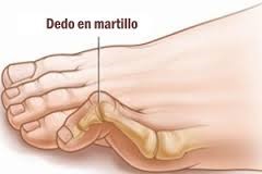 Dits en urpa tractament a NOU DMP