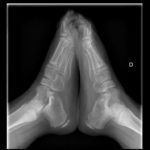 Serve Infantil NOU-DMP